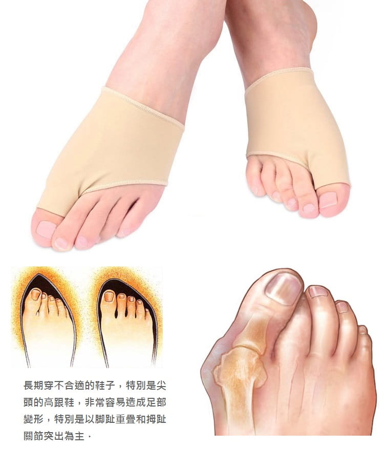 腳拇指外翻矽膠保謢套 大拇指骨套 大脚趾外翻 (1雙入)【AF02201】 3